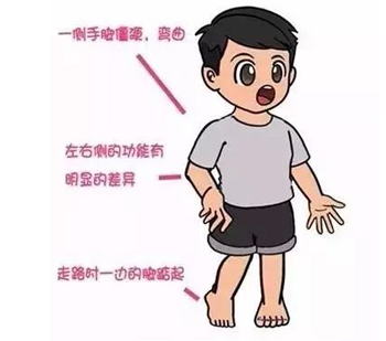 脑瘫患儿家长最关心的问题