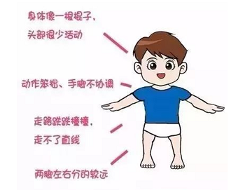 脑瘫患儿家长最关心的问题