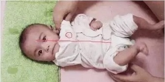 影响孩子运动发育的原因究竟是什么?家长如何判断?