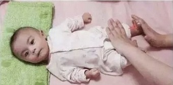 影响孩子运动发育的原因究竟是什么?家长如何判断?
