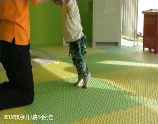 康复知识丨痉挛型患儿康复中强行练走的误区
